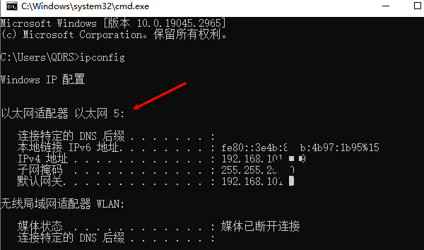 电脑本地连接在哪里找 电脑没有本地连接解决方法