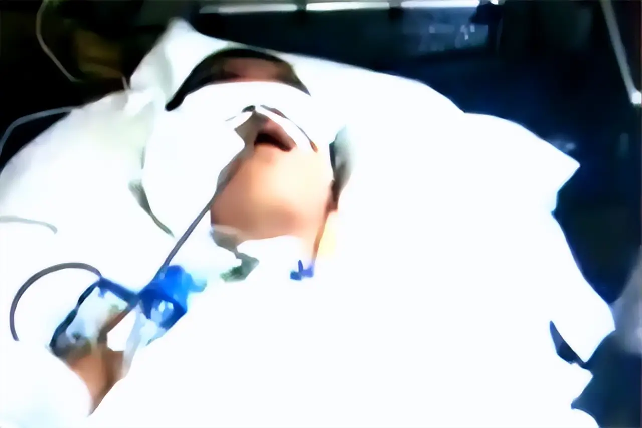 2012年,山东13岁男孩遭高压泵充气,内脏20处穿孔,医生无能为力