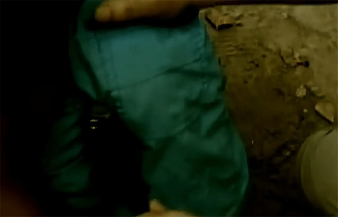 2012年,山东13岁男孩遭高压泵充气,内脏20处穿孔,医生无能为力