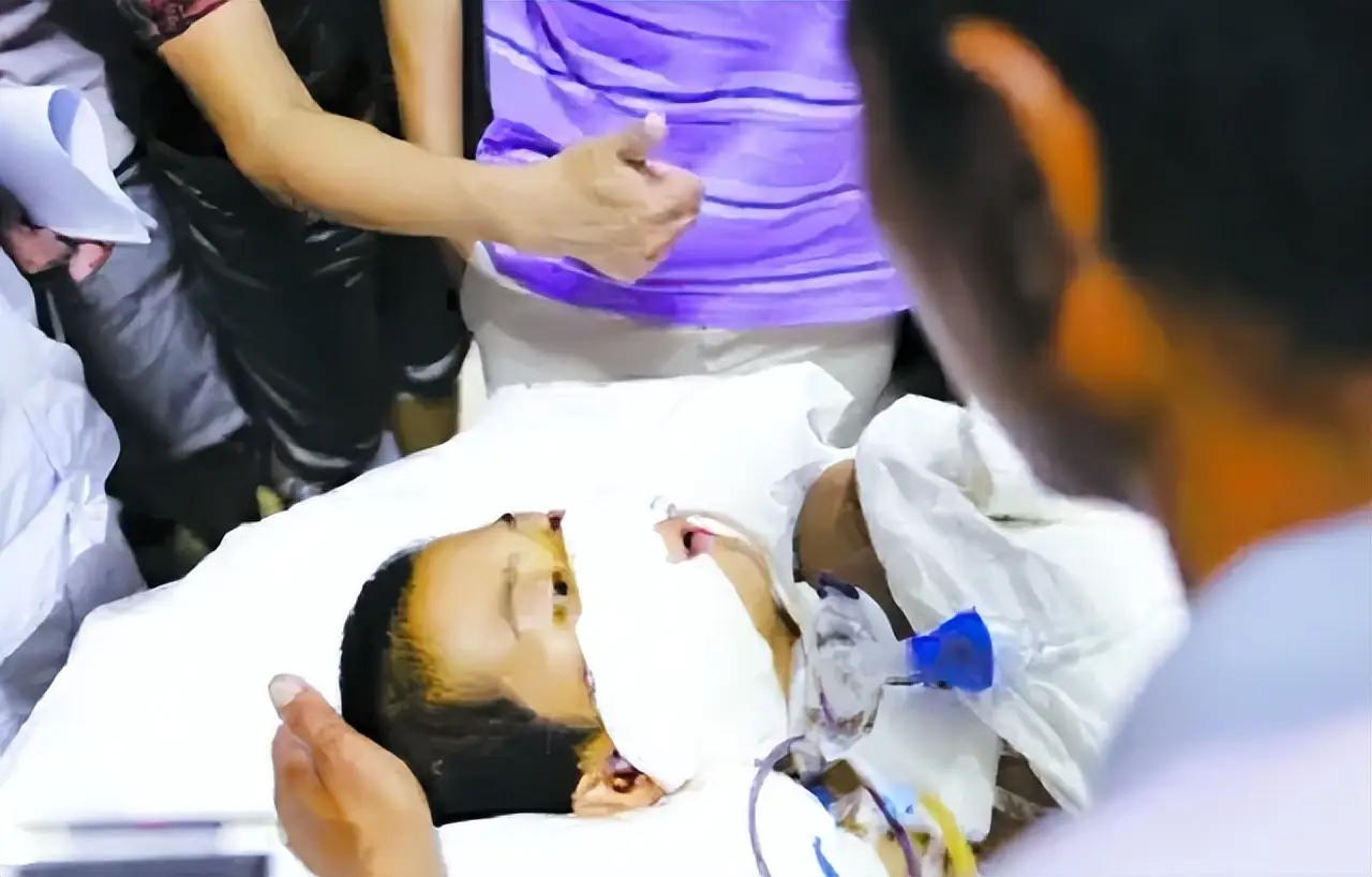 2012年,山东13岁男孩遭高压泵充气,内脏20处穿孔,医生无能为力