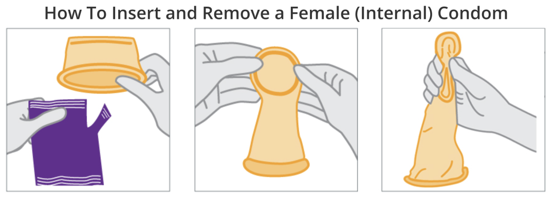 性与生命 | 避孕（十）：安全套，中间一套，无忧无虑吗？（III）