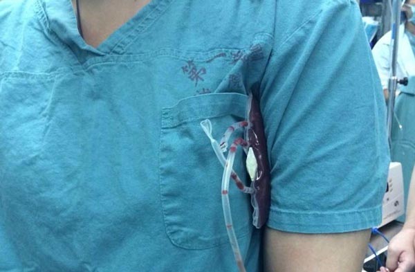 上海一产妇突发羊水栓塞，多家医院合力成功抢救过程被披露