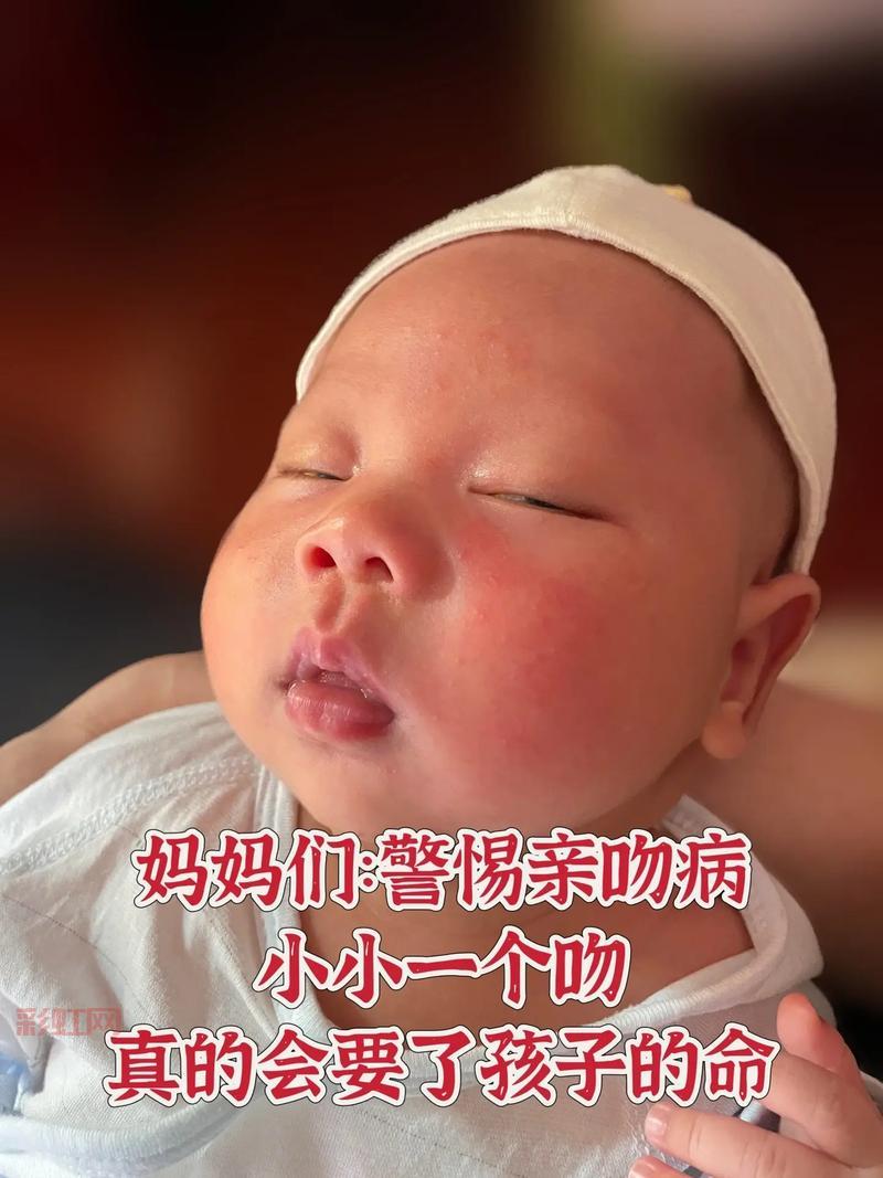 深圳18岁男孩接吻病发作，高烧三天不退情况严重