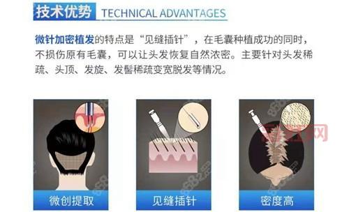 瓶洁精灵效果怎么样？对比其他产品优势在哪里？
