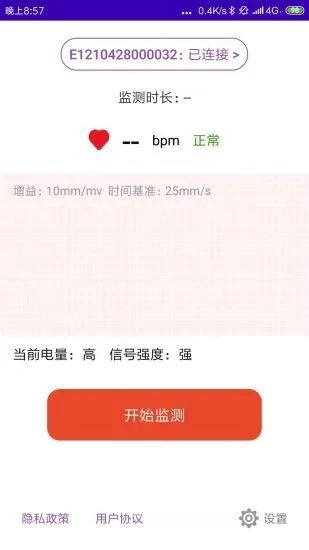 心电监测软件优势