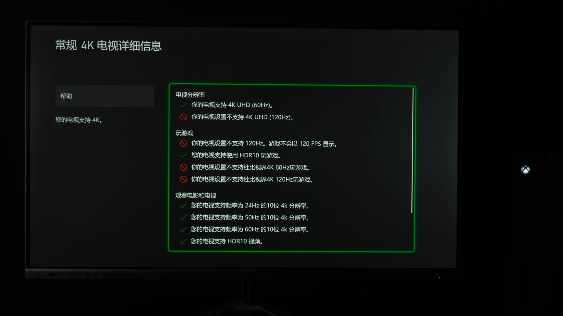 Xbox Series X开箱及PS5、XGP等购买建议