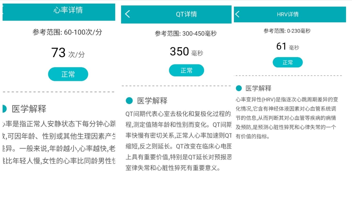 如影随形的私人健康管家，智能健康监测手环dido y1s体验评测