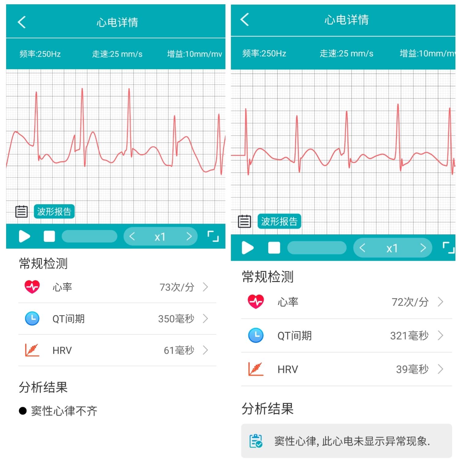 如影随形的私人健康管家，智能健康监测手环dido y1s体验评测