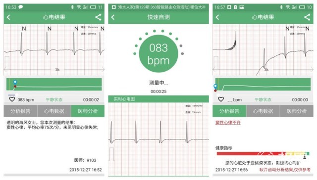 心脏健康的守护神 ：泰控心仪心电监控体验