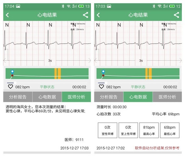 心脏健康的守护神 ：泰控心仪心电监控体验