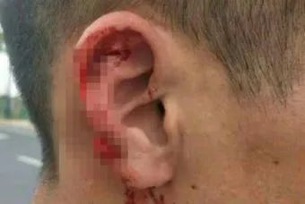 近期“碰瓷儿”高发！遇到就报警