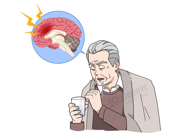 体内有癌，吃饭先知？吃饭出现这2种异常，警惕是身体警报