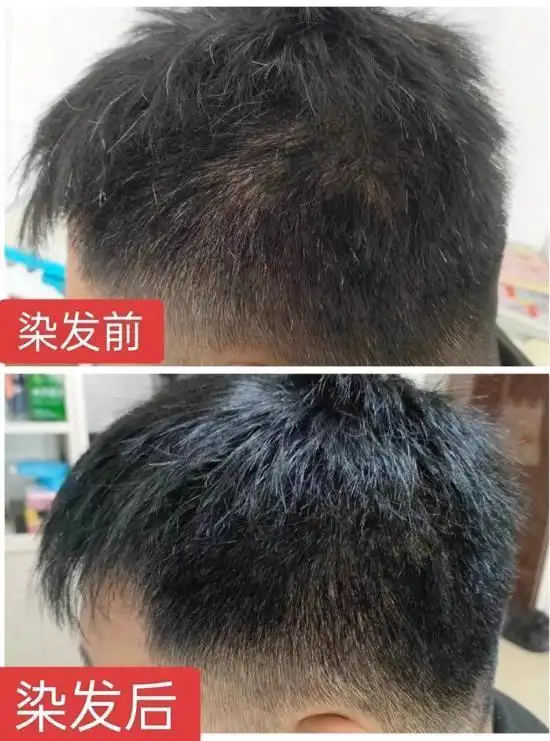 黑色染发剂哪个牌子最好最安全?家用无刺激自然黑染发剂推荐,2026安全遮白黑染品牌精选