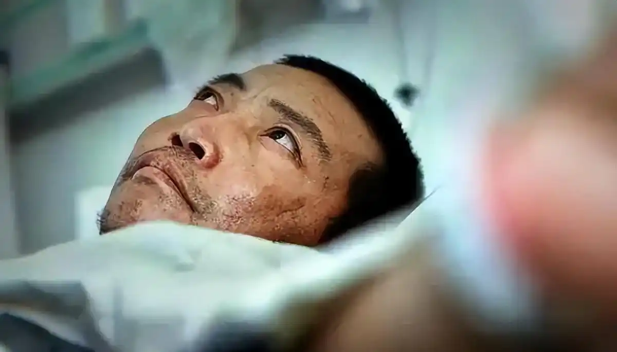 12年前因无钱治疗在家锯腿求生的河北男子，现在过得如何？