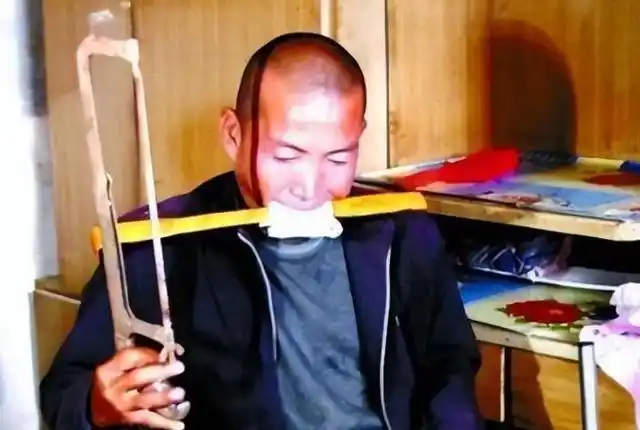 河北男子拿不出100万手术费，回家自己锯掉右腿，12年过去怎样了