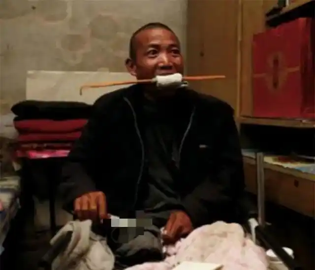 河北男子拿不出100万手术费，回家自己锯掉右腿，12年过去怎样了