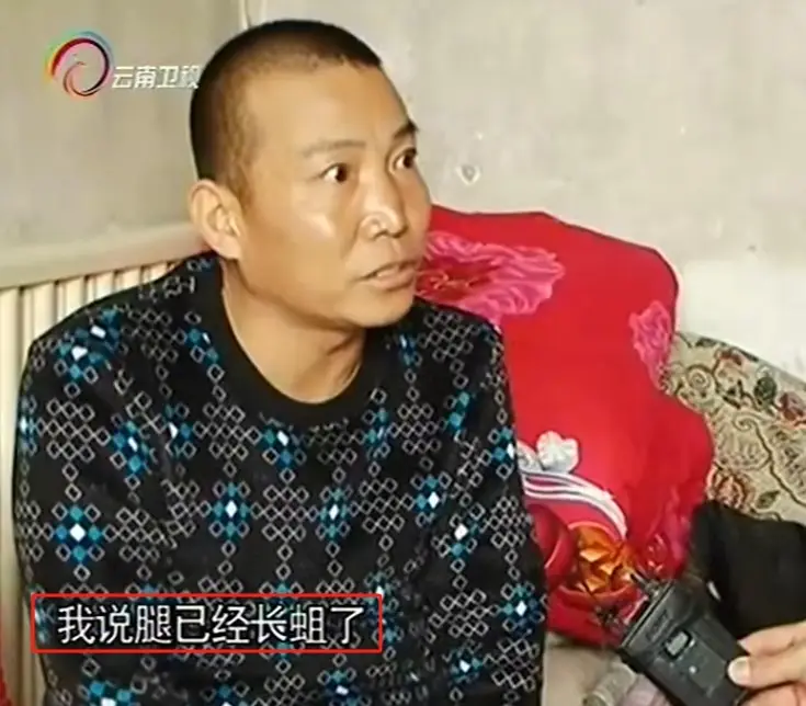 河北男子拿不出100万手术费，回家自己锯掉右腿，12年过去怎样了