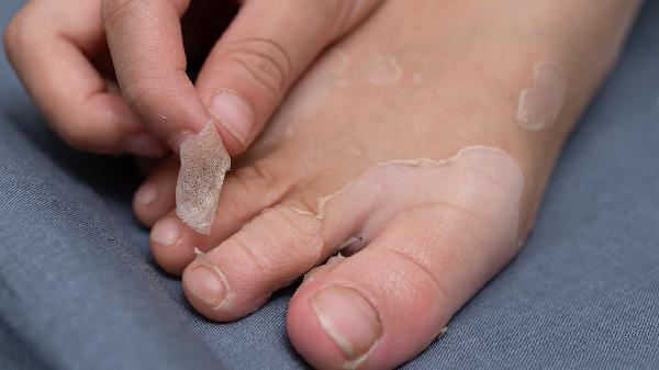 7个月的婴儿拉肚子发烧呕吐