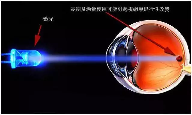 手机蓝光烦恼多，橙红模式与护眼壁纸能否解忧？