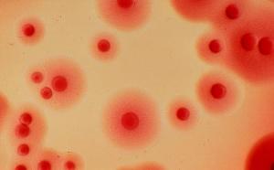 16家知名快餐业被点名，中国养殖业该不该禁用抗生素？