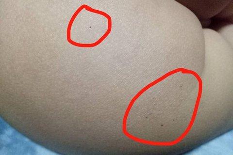 专家解读幼儿园虐童：社会对“儿童伤害行为”没有共识